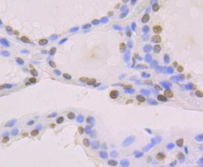 Immunohistochemistry-Paraffin: Histone H2AY/macroH2A.1 Antibody (JU22-83) [NBP2-75523] - Analysis of paraffin-embedded human thyroid gland tissue using anti-macroH2A.1 antibody. Counter stained with hematoxylin.