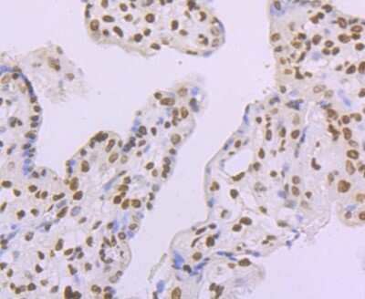 Immunohistochemistry-Paraffin: Histone H2AY/macroH2A.1 Antibody (JU22-83) [NBP2-75523] - Analysis of paraffin-embedded human placenta tissue using anti-macroH2A.1 antibody. Counter stained with hematoxylin.