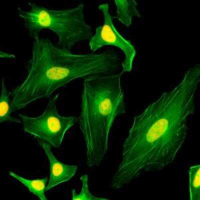 Immunocytochemistry/Immunofluorescence: Histone H2AY/macroH2A.1 Antibody (RM248) [NBP2-61494] - Immunocytochemistry of HeLa cells, using NBP2-61494 (red). Actin filaments have been labeled with fluorescein phalloidin (green).