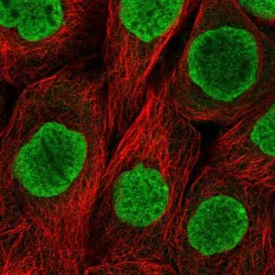 Immunocytochemistry/Immunofluorescence: Histone H2AY/macroH2A.1 Antibody [NBP2-56819] - Staining of human cell line A-431 shows localization to nucleoplasm.