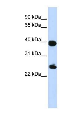 Western Blot: Histone H2AY/macroH2A.1 Antibody [NBP1-53002] - 293T cells lysate, concentration 0.2-1 ug/ml.