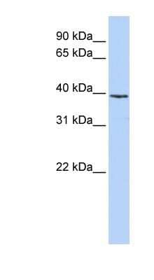 Western Blot: Histone H2AY/macroH2A.1 Antibody [NBP1-53003] - MCF-7 whole cell lysates, concentration 0.2-1 ug/ml.