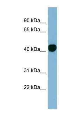 Western Blot: Histone H2AY/macroH2A.1 Antibody [NBP1-53018] - NCI-H226 cell lysate, concentration 0.2-1 ug/ml.
