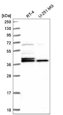 Western Blot: Histone H2AY/macroH2A.1 Antibody [NBP2-56819] - Analysis in human cell line RT-4 and human cell line U-251 MG.