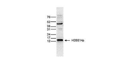 Western Blot: Histone H2B, member S [p Ser14] Antibody (C.15200186) [NBP2-62794] - HeLa cells were treated with colcemid to block the cell cycle in metaphase and histone extracts of these cells were analysed using the antibody against H2BS14p.