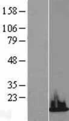 Western Blot: Histone H3.3B Overexpression Lysate (Adult Normal) [NBL1-11429] - Western Blot experiments.  Left-Control; Right -Over-expression Lysate for H3F3B.