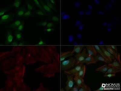 Immunocytochemistry/Immunofluorescence: Histone H3 Antibody (1B1-B2) - Azide and BSA Free [NBP2-80770] - HeLa cells were fixed for 10 minutes using 10% formalin and then permeabilized for 5 minutes using 1X TBS + 0.5% Triton X-100. The cells were incubated with anti-Histone H3 (1B1-B2) NBP2-36468 at a 1:200 dilution overnight at 4C and detected with an anti-mouse DyLight 488 (Green) at a 1:500 dilution. Actin was detected with Phalloidin 568 (Red) at a 1:200 dilution. Nuclei were counterstained with DAPI (Blue). Cells were imaged using a 40X objective. Image from the standard format of this antibody.