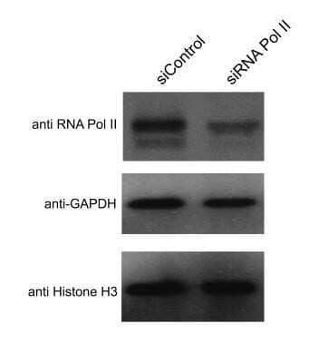 Western Blot: Histone H3 Antibody (1B1-B2) - Azide and BSA Free [NBP2-80770] - Analysis in Hela cells using siRNA to knockdown Pol II, controls are GAPDH and Histone H3. Theoretical molecular weight of Histone H3 is 15 kDa. WB blot image submitted by a verified customer review. Image from the standard format of this antibody.