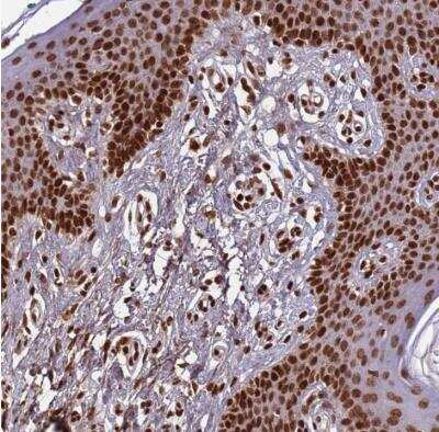 Immunohistochemistry-Paraffin: Histone H3 Antibody [NBP2-54701] - Staining of human vulva/anal skin shows strong nuclear positivity in epidermal cells.
