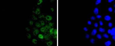 Immunocytochemistry/Immunofluorescence: Histone H3 Antibody (JJ092-08) [NBP2-67908] - Staining Histone H3 in RH-35 cells (green). The nuclear counter stain is DAPI (blue). Cells were fixed in paraformaldehyde, permeabilised with 0.25% Triton X100/PBS.