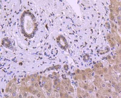 Immunohistochemistry-Paraffin: Histone H3 Antibody (JJ092-08) [NBP2-67908] - Analysis of paraffin-embedded human liver tissue using anti-Histone H3 antibody. Counter stained with hematoxylin.