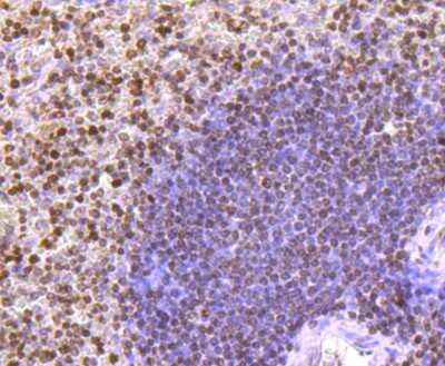 Immunohistochemistry-Paraffin: Histone H3 Antibody (JJ092-08) [NBP2-67908] - Analysis of paraffin-embedded human spleen tissue using anti-Histone H3 antibody. Counter stained with hematoxylin.