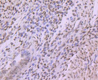 Immunohistochemistry-Paraffin: Histone H3 Antibody (JJ092-08) [NBP2-67908] - Analysis of paraffin-embedded human uterus tissue using anti-Histone H3 antibody. Counter stained with hematoxylin.