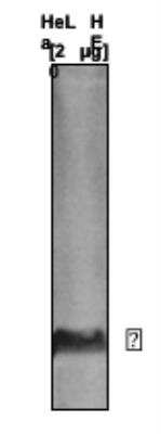 Western Blot: Histone H3 [Dimethyl Lys27, Trimethyl Lys27] Antibody (C.15200014) [NBP2-59278] - Analysis using the monoclonal antibody against H3K27me2/3. Histone extracts from HeLa cells (20 ug) were analysed by Western blot using the monoclonal antibody against H3K27me2/3 diluted 1:1000 in TBS-Tween containing 5% skimmed milk. Theoretical molecular weight is ~15 kDa.