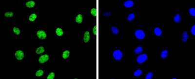 Immunocytochemistry/Immunofluorescence: Histone H3 [Dimethyl Lys9] Antibody (SN07-30) [NBP2-67685] - Staining Histone H3(di methyl K9) in L6 cells (green). The nuclear counter stain is DAPI (blue). Cells were fixed in paraformaldehyde, permeabilised with 0.25% Triton X100/PBS.