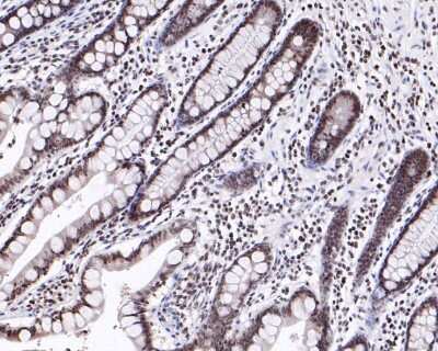 Immunohistochemistry-Paraffin: Histone H3 [Dimethyl Lys9] Antibody (SN07-30) [NBP2-67685] - Immunohistochemical analysis of paraffin-embedded human small intestine tissue using anti-Histone H3 antibody. The section was pre-treated using heat mediated antigen retrieval with sodium citrate buffer (pH 6.0) for 20 minutes. The tissues were blocked in 5% BSA for 30 minutes at room temperature, washed with ddH2O and PBS, and then probed with the primary antibody (1/200) for 30 minutes at room temperature. The detection was performed using an HRP conjugated compact polymer system. DAB was used as the chromogen. Tissues were counterstained with hematoxylin and mounted with DPX.
