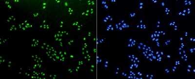 Immunocytochemistry/Immunofluorescence: Histone H3 [Monomethyl Lys18] Antibody (SA42-07) [NBP2-67289] - Staining Histone H3(mono methyl K18) in HepG2 cells (green). The nuclear counter stain is DAPI (blue). Cells were fixed in paraformaldehyde, permeabilised with 0.25% Triton X100/PBS.