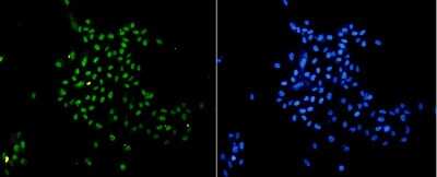 Immunocytochemistry/Immunofluorescence: Histone H3 [Monomethyl Lys18] Antibody (SA42-07) [NBP2-67289] - Staining Histone H3(mono methyl K18) in PC-3M cells (green). The nuclear counter stain is DAPI (blue). Cells were fixed in paraformaldehyde, permeabilised with 0.25% Triton X100/PBS.