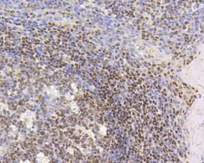 Immunohistochemistry-Paraffin: Histone H3 [Monomethyl Lys18] Antibody (SA42-07) [NBP2-67289] - Immunohistochemical analysis of paraffin-embedded mouse kidney tissue using anti-Histone H3 antibody. Counter stained with hematoxylin.
