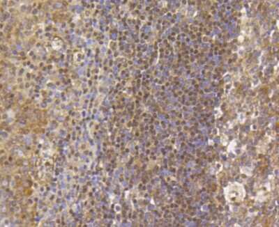 Immunohistochemistry-Paraffin: Histone H3 [Trimethyl Lys79] Antibody (SR42-06) [NBP2-67343] - Analysis of paraffin-embedded human tonsil tissue using anti-Histone H3(mono+di+tri methyl K79) antibody. Counter stained with hematoxylin.