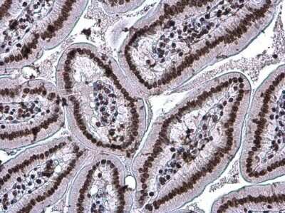 Immunohistochemistry-Paraffin: Histone H3 [ac Lys27] Antibody (GT261) [NBP3-13553] - Histone H3 (acetyl Lys27) antibody [GT261] detects Histone H3 (acetyl Lys27) protein at nucleus in mouse duodenum by immunohistochemical analysis. Sample: Paraffin-embedded mouse duodenum. Histone H3 (acetyl Lys27) antibody [GT261] (NBP3-13553) diluted at 1:200. Antigen Retrieval: Citrate buffer, pH 6.0, 15 min