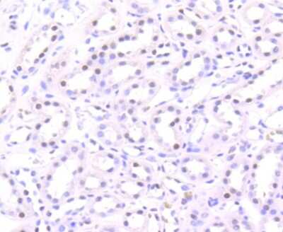 Immunohistochemistry-Paraffin: Histone H3 [ac Lys56] Antibody (SU30-10) [NBP2-67489] - Analysis of paraffin-embedded human kidney tissue using anti-Histone H3(acetyl K56) antibody. Counter stained with hematoxylin.