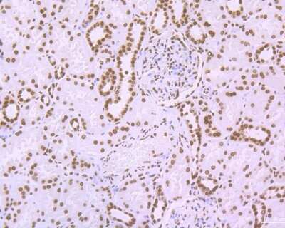 Immunohistochemistry-Paraffin: Histone H3 [ac Lys56] Antibody (SU30-10) [NBP2-67489] - Immunohistochemical analysis of paraffin-embedded human kidney tissue using anti-Histone H3 antibody. The section was pre-treated using heat mediated antigen retrieval with Tris-EDTA buffer (pH 8.0-8.4) for 20 minutes. The tissues were blocked in 5% BSA for 30 minutes at room temperature, washed with ddH2O and PBS, and then probed with the primary antibody (ET1608-9, 1/50) for 30 minutes at room temperature. The detection was performed using an HRP conjugated compact polymer system. DAB was used as the chromogen. Tissues were counterstained with hematoxylin and mounted with DPX.