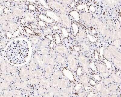 Immunohistochemistry-Paraffin: Histone H3 [ac Lys56] Antibody (SU30-10) [NBP2-67489] - Analysis of paraffin-embedded human kidney tissue with Rabbit anti-Histone H3[ac LysK56] antibody washed with ddH2O and PBS, and then probed with the primary antibody  at 1/800 dilution for 1 hour at room temperature. The detection was performed using an HRP conjugated compact polymer system. DAB was used as the chromogen. Tissues were counterstained with hematoxylin and mounted with DPX.