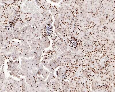 Immunohistochemistry-Paraffin: Histone H3 [ac Lys56] Antibody (SU30-10) [NBP2-67489] - Analysis of paraffin-embedded mouse kidney tissue with Rabbit Histone H3 [ac Lys56] antibody washed with ddH2O and PBS, and then probed with the primary antibody at 1/800 dilution for 1 hour at room temperature. The detection was performed using an HRP conjugated compact polymer system. DAB was used as the chromogen. Tissues were counterstained with hematoxylin and mounted with DPX.