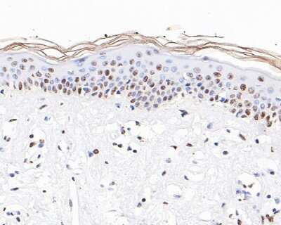 Immunohistochemistry-Paraffin: Histone H3 [ac Lys56] Antibody (SU30-10) [NBP2-67489] - Analysis of paraffin-embedded human skin tissue with Rabbit anti-Histone H3 [ac Lys56) antibody washed with ddH2O and PBS, and then probed with the primary antibody  at 1/200 dilution for 1 hour at room temperature. The detection was performed using an HRP conjugated compact polymer system. DAB was used as the chromogen. Tissues were counterstained with hematoxylin and mounted with DPX.