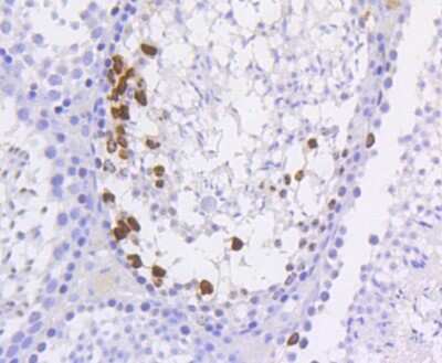 Immunohistochemistry-Paraffin: Histone H3 [p Ser10] Antibody (SA31-01) [NBP2-67305] - Analysis of paraffin-embedded mouse testis tissue using anti-Phospho-Histone H3(S10) antibody. Counter stained with hematoxylin.