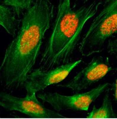 Immunocytochemistry/Immunofluorescence: Histone H4 Antibody (RM212) [NBP2-61555] - Immunocytochemistry of HeLa cells, using Histone H4 Rabbit mAb NBP2-61555 (red). Actin filaments have been labeled with fluorescein phalloidin (green).