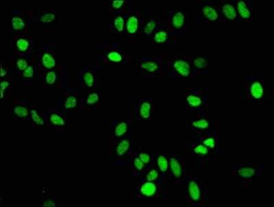 Immunocytochemistry/Immunofluorescence: Histone H4 [Monomethyl Lys16] Antibody (3E11) [NBP3-15232] - Immunofluorescence staining of Hela cells with Histone H4 antibody at 1:50, counter-stained with DAPI. The cells were fixed in 4% formaldehyde, permeabilized using 0.2% Triton X-100 and blocked in 10% normal Goat Serum. The cells were then incubated with the antibody overnight at 4C. The secondary antibody was Alexa Fluor 488-congugated Goat Anti-Rabbit IgG (H+L).