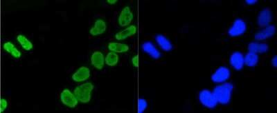 Immunocytochemistry/Immunofluorescence: Histone H4 [ac Lys5] Antibody (SR31-07) [NBP2-67342] - Staining Histone H4(acetyl K5) in Hela cells (green). The nuclear counter stain is DAPI (blue). Cells were fixed in paraformaldehyde, permeabilised with 0.25% Triton X100/PBS.
