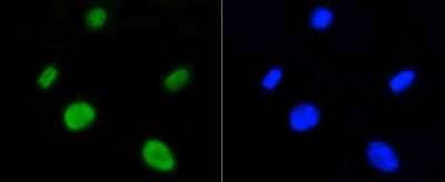 Immunocytochemistry/Immunofluorescence: Histone H4 [ac Lys5] Antibody (SR31-07) [NBP2-67342] - Staining Histone H4(acetyl K5) in SH-SY-5Y cells (green). Cells were fixed in paraformaldehyde, permeabilised with 0.25% Triton X100/PBS.
