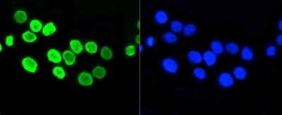 Immunocytochemistry/Immunofluorescence: Histone H4 [ac Lys5] Antibody (SR31-07) [NBP2-67342] - Staining Histone H4(acetyl K5) in CRC cells (green). The nuclear counter stain is DAPI (blue). Cells were fixed in paraformaldehyde, permeabilised with 0.25% Triton X100/PBS.