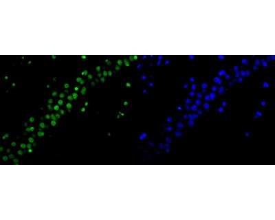 Immunocytochemistry/Immunofluorescence: Histone H4 [ac Lys5] Antibody (SR31-07) [NBP2-67342] - Immunofluorescence staining of paraffin- embedded rat brain tissue using anti-Histone H4 rabbit polyclonal antibody. The section was pre-treated using heat mediated antigen retrieval with Tris-EDTA buffer (pH 9.0) for 20 minutes.(sodium citrate buffer (pH6) for 20 mins.) The tissues were blocked in 10% negative goat serum for 1 hour at room temperature, washed with PBS, and then probed with ET1602-40 at 1/300 dilution for 10 hours at 4C and detected using Alexa Fluor(R) 488 conjugate-Goat anti-Rabbit IgG (H+L) Secondary Antibody at a dilution of 1:500 for 1 hour at room temperature.