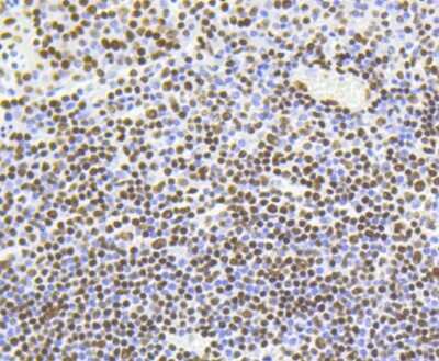 Immunohistochemistry-Paraffin: Histone H4 [ac Lys5] Antibody (SR31-07) [NBP2-67342] - Analysis of paraffin-embedded human tonsil tissue using anti-Histone H4(acetyl K5) antibody. Counter stained with hematoxylin.