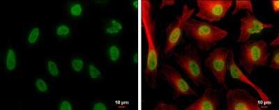 <b>Biological Strategies Validation. </b>Immunocytochemistry/Immunofluorescence: Histone H4 [ac Lys8] Antibody (GT478) [NBP3-13539] - Histone H4 (acetyl Lys8) antibody [GT478] detects Histone H4 (acetyl Lys8) protein at nucleus by immunofluorescent analysis. Sample: HeLa cells were fixed in 4% paraformaldehyde at RT for 15 min. Green: Histone H4 (acetyl Lys8) protein stained by Histone H4 (acetyl Lys8) antibody [GT478] (NBP3-13539) diluted at 1:400. Red: alpha Tubulin, a cytoskeleton marker, stained by alpha Tubulin antibody (NBP2-20759) diluted at 1:300. Scale bar = 10 um.