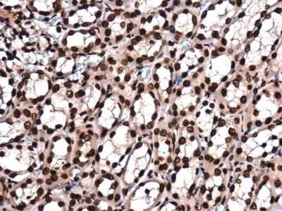 Immunohistochemistry-Paraffin: Histone H4 [ac Lys8] Antibody (GT478) [NBP3-13539] - Histone H4 (acetyl Lys8) antibody [GT478] detects Histone H4 (acetyl Lys8) protein at cytoplasm and nucleus in rat kidney by immunohistochemical analysis. Sample: Paraffin-embedded rat kidney. Histone H4 (acetyl Lys8) antibody [GT478] (NBP3-13539) diluted at 1:200. Antigen Retrieval: Citrate buffer, pH 6.0, 15 min