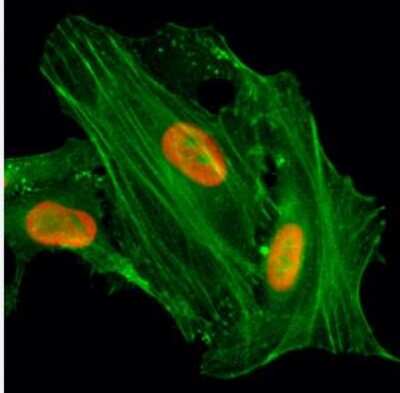 Immunocytochemistry/Immunofluorescence: Histone H4 [ac Lys8] Antibody (RM201) [NBP2-61558] - Immunocytochemistry of HeLa cells treated with sodium butyrate, using NBP2-61558 (red). Actin filaments have been labeled with fluorescein phalloidin (green).