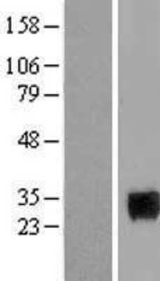 Western Blot: Homeobox protein SIX6 Overexpression Lysate (Adult Normal) [NBL1-15985] Left-Empty vector transfected control cell lysate (HEK293 cell lysate); Right -Over-expression Lysate for Homeobox protein SIX6.