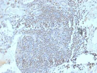 Immunohistochemistry-Paraffin: Homez Antibody (PCRP-HOMEZ-1A5) [NBP3-08302] - Formalin-fixed, paraffin-embedded human lymph node stained with Homez Mouse Monoclonal Antibody (PCRP-Homez-1A5).