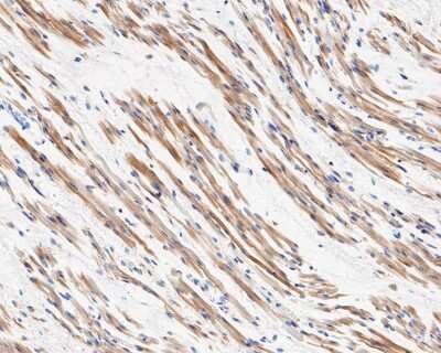 Immunohistochemistry-Paraffin: Hormone-sensitive Lipase/HSL [p Ser853] Antibody (SN06-39) [NBP2-67655] - Immunohistochemical analysis of paraffin-embedded human fetal skeletal muscle tissue using anti-Hormone-sensitive Lipase/HSL antibody. The section was pre-treated using heat mediated antigen retrieval with Tris-EDTA buffer (pH 8.0-8.4) for 20 minutes. The tissues were blocked in 5% BSA for 30 minutes at room temperature, washed with ddH2O and PBS, and then probed with the primary antibody (1/50) for 30 minutes at room temperature. The detection was performed using an HRP conjugated compact polymer system. DAB was used as the chromogen. Tissues were counterstained with hematoxylin and mounted with DPX.