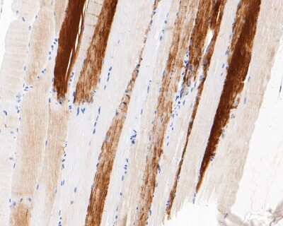 Immunohistochemistry-Paraffin: Hormone-sensitive Lipase/HSL [p Ser853] Antibody (SN06-39) [NBP2-67655] - Immunohistochemical analysis of paraffin-embedded mouse skeletal muscle tissue using anti-Hormone-sensitive Lipase/HSL antibody. The section was pre-treated using heat mediated antigen retrieval with Tris-EDTA buffer (pH 8.0-8.4) for 20 minutes. The tissues were blocked in 5% BSA for 30 minutes at room temperature, washed with ddH2O and PBS, and then probed with the primary antibody (1/200) for 30 minutes at room temperature. The detection was performed using an HRP conjugated compact polymer system. DAB was used as the chromogen. Tissues were counterstained with hematoxylin and mounted with DPX.