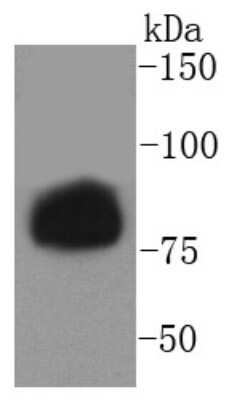 Western Blot: Hormone-sensitive Lipase/HSL [p Ser853] Antibody (SN06-39) [NBP2-67655] - Analysis of phospho -Hormone sensitive lipase (S853) on human skeletal muscle lysates using anti- phospho -Hormone sensitive lipase (S853) antibody at 1/1,000 dilution.