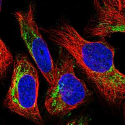 Immunocytochemistry/ Immunofluorescence Hornerin Antibody