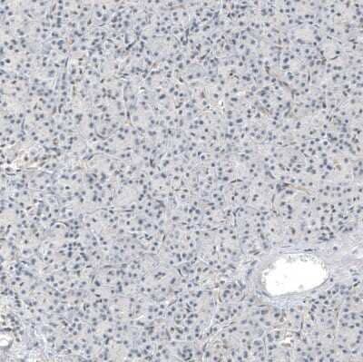 Immunohistochemistry-Paraffin Hornerin Antibody