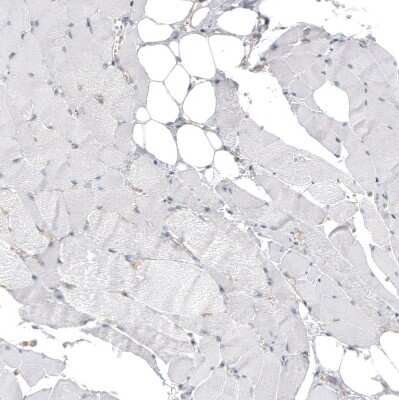 Immunohistochemistry-Paraffin Hornerin Antibody