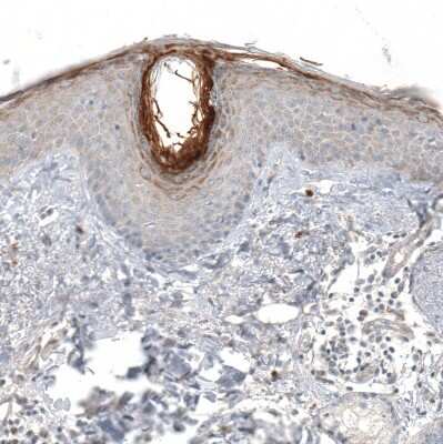 Immunohistochemistry-Paraffin: Hornerin Antibody [NBP1-80807] - Staining of human skin shows moderate to strong cytoplasmic granular positivity in the cornified layer.